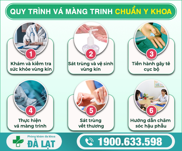 Hình ảnh minh họa